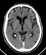 /dateien/0,1297515618,ct brain akt 512x512