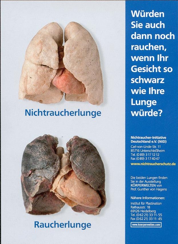 /dateien/pr22374,1140547116,lunge