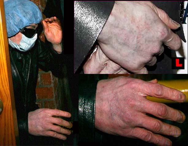 /dateien/ug55144,1256125518,michael-jackson-hands-manicure-ni.txtare