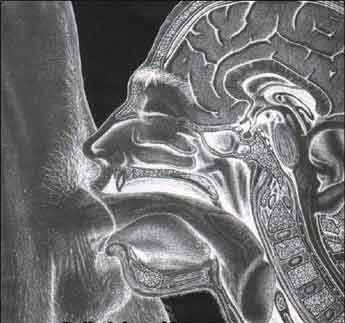 /dateien/uh69924,1295976670,xray1