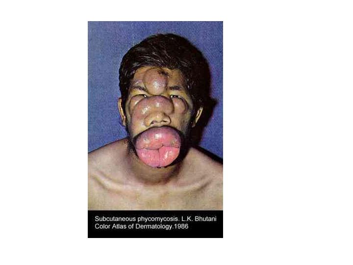 dicke lippe