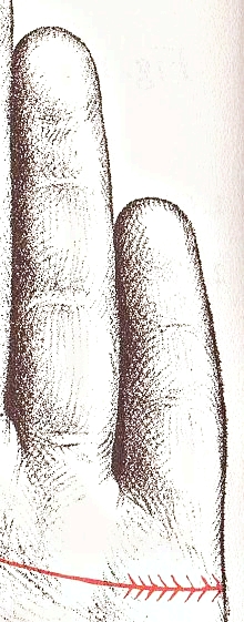 mvkpkg