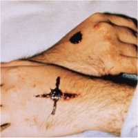 stigmata