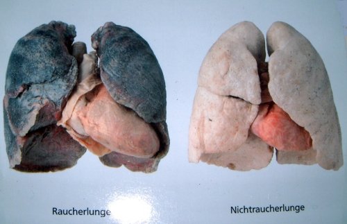 raucherlunge-nichtraucherlunge