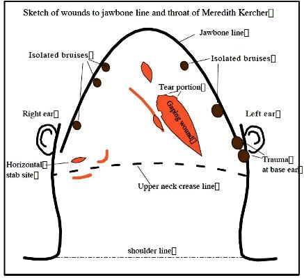 t7cd045 wounds2