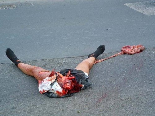 motorcycleaccident 07