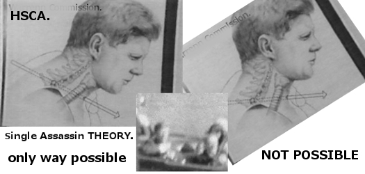 single bullet magic theory