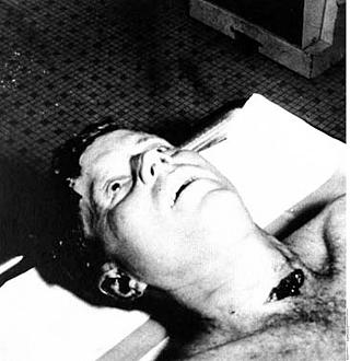 kennedy-attentat-3