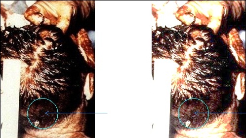 JFKbackofthehead