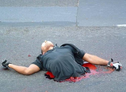 motorcycleaccident 04
