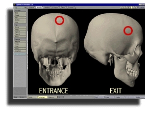 myers head