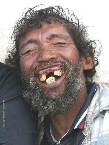 Ugly-smile