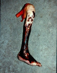 37 GrossLeg