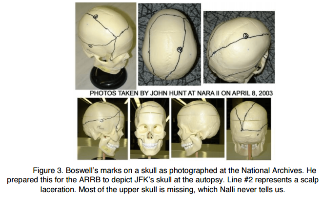 boswellsull