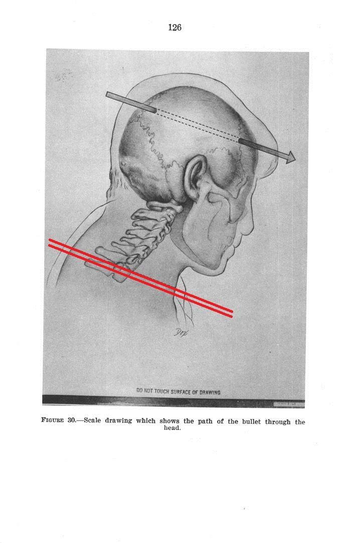 skull-trajectory z312-pose