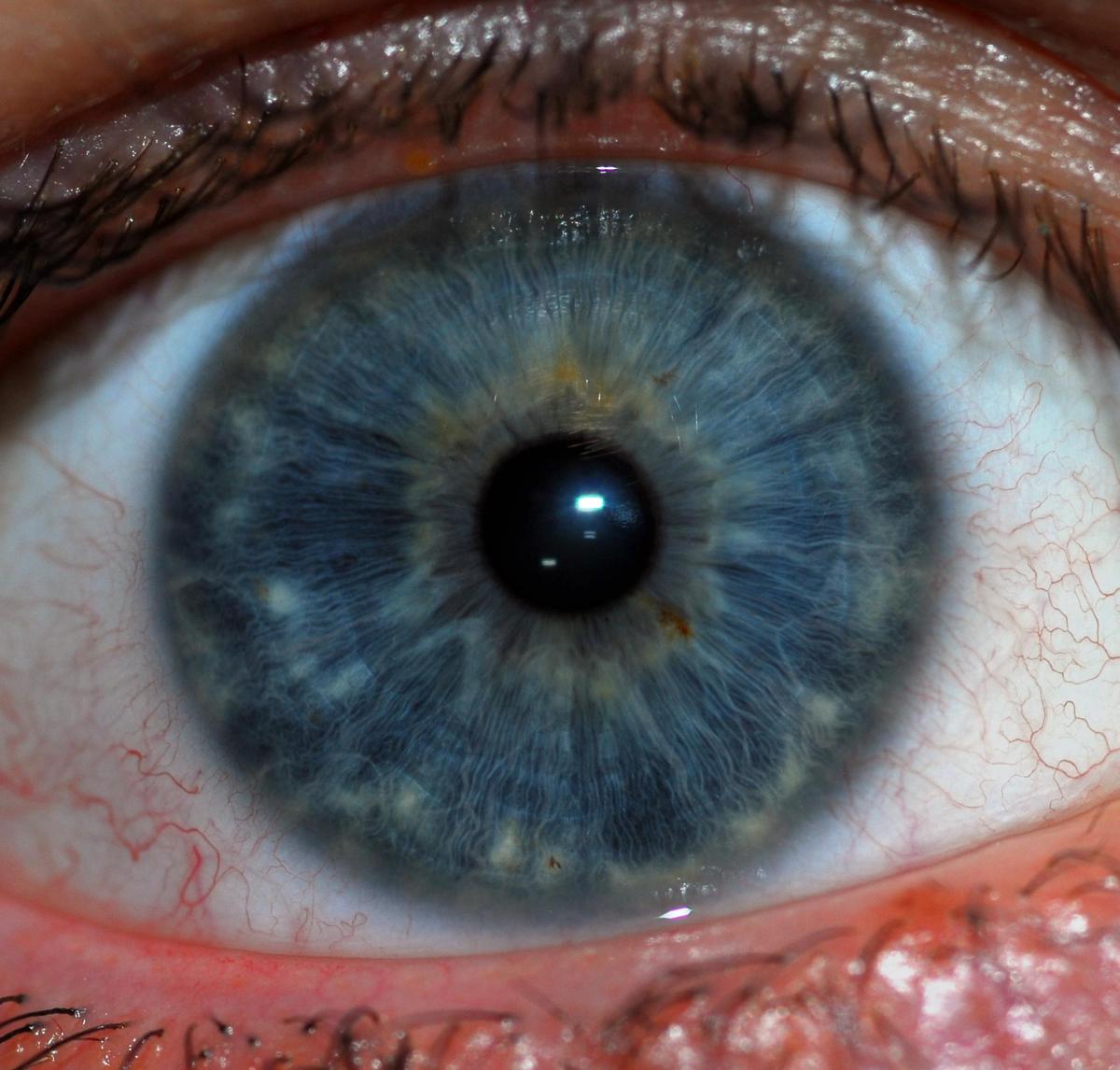 Human Iris JD052007