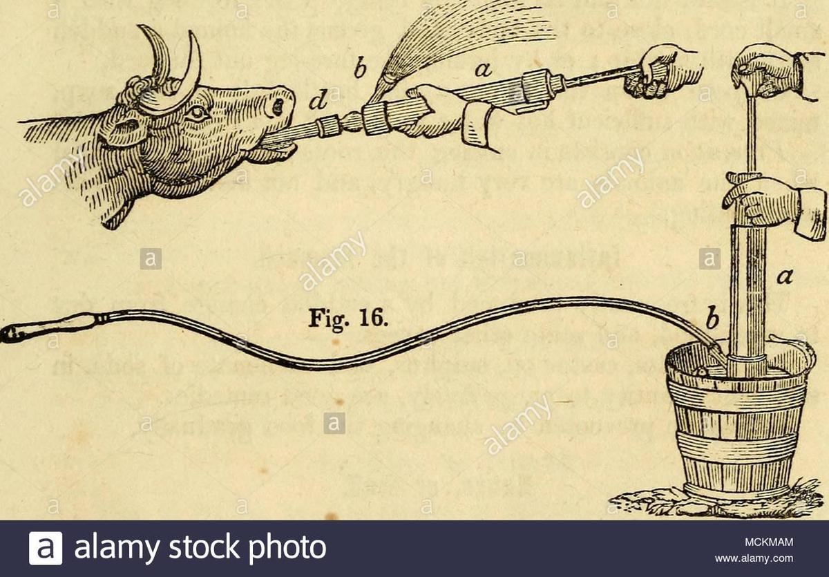 der-magen-pumpe-dies-ist-ein-praktisches