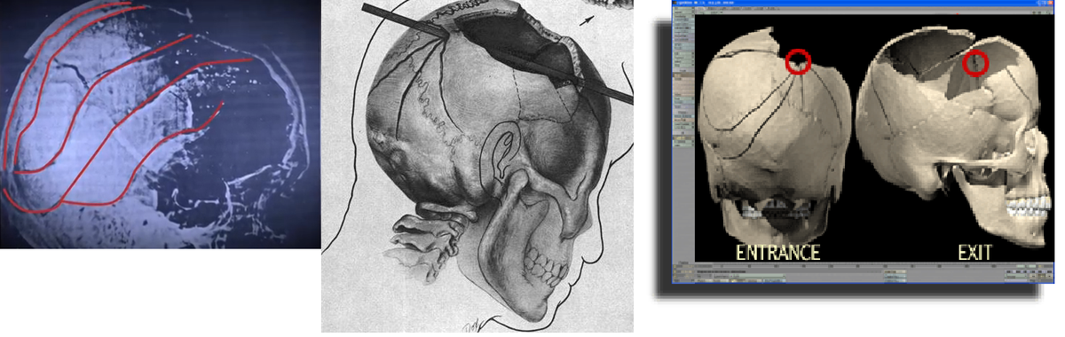 db46dc7d92c9 fractures