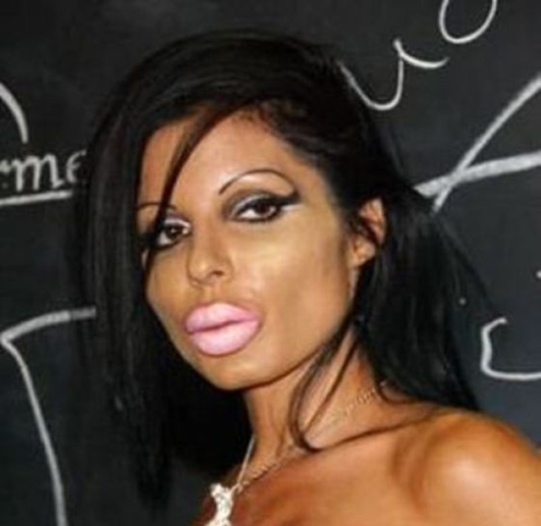 plastic-surgery-failseqlnn