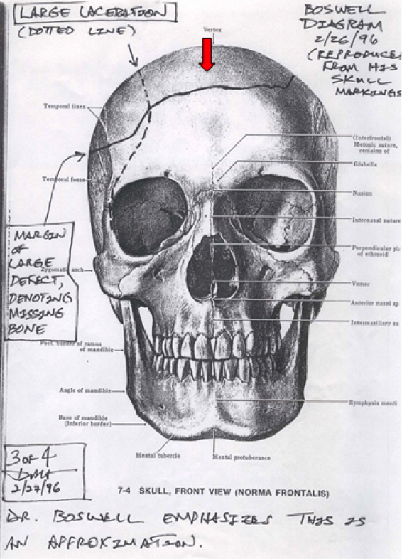 fig12