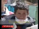 Youtube: How Turkish Ununiformed Policemen Break Arm of a Kurdish Child in Turkey..