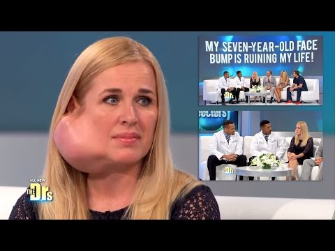 Youtube: My Journey with a Parotid Tumor on The Doctors TV Show Changed My Life