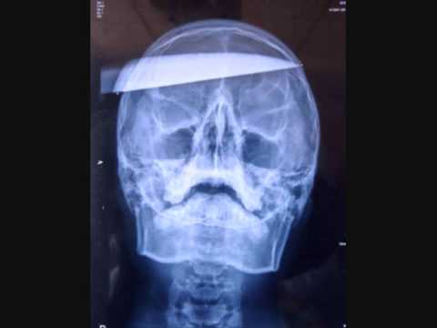 Youtube: Dub-Rex - Stab Ya Brain (HARD DUBSTEP)
