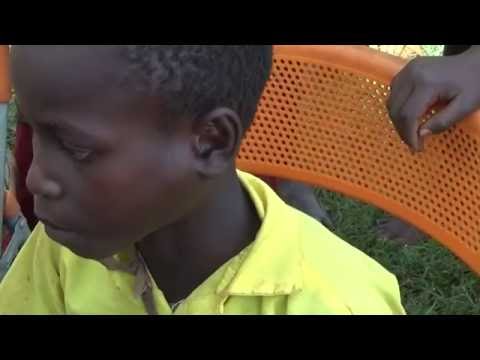 Youtube: ROBIN (9) HUGE JIGGERS - TOES to FINGERS! (1 of 2)