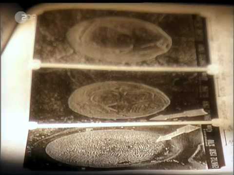Youtube: Und keiner weiß warum: Leukämietod in der Elbmarsch /08.06.2006