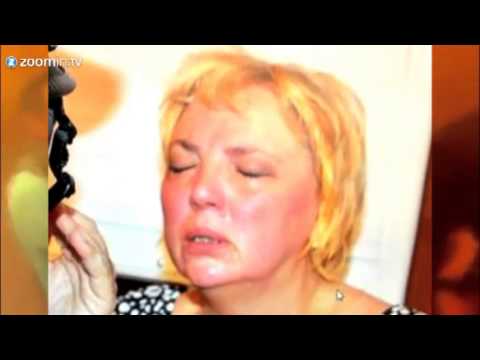 Youtube: Claudia Roth durch Tränengas verletzt  Attacke im Gezi Park